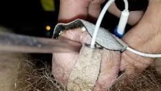 Reproduzir Eu enfiando o estim escolhido atravessou e atravessou o interior do tubo impressionante da minha uretra até os esfíncteres anatômicos e assim o escolhido entrou na minha vesica
